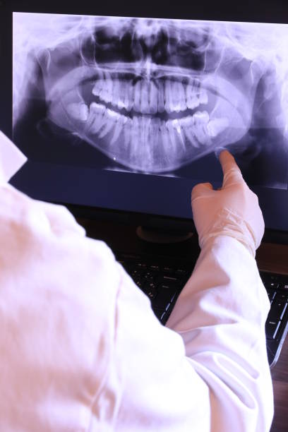 Best Emergency Gum Treatment in El Lago, TX