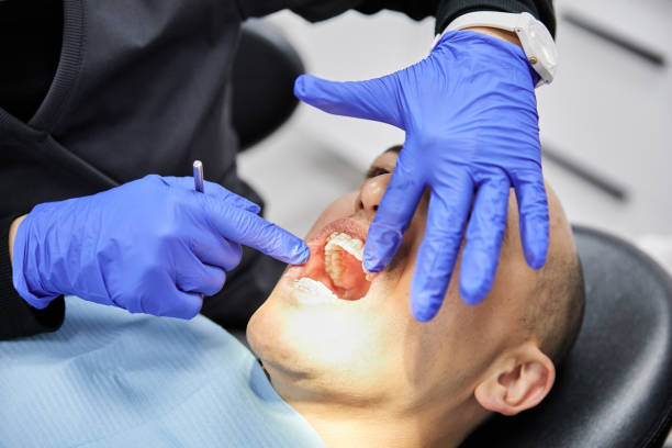 Best Emergency Wisdom Teeth Removal in El Lago, TX