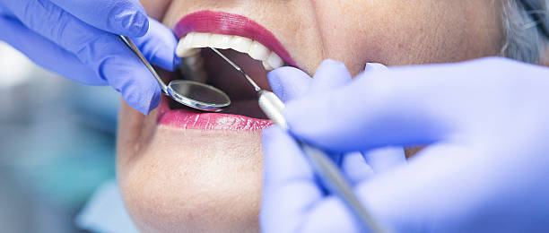 Best Emergency Tooth Extraction in El Lago, TX